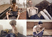 Madaya : une nouvelle manipulation médiatique