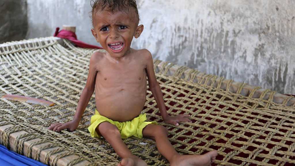 Yémen : un million d’enfants menacés de famine après l’offensive sur Hodeida