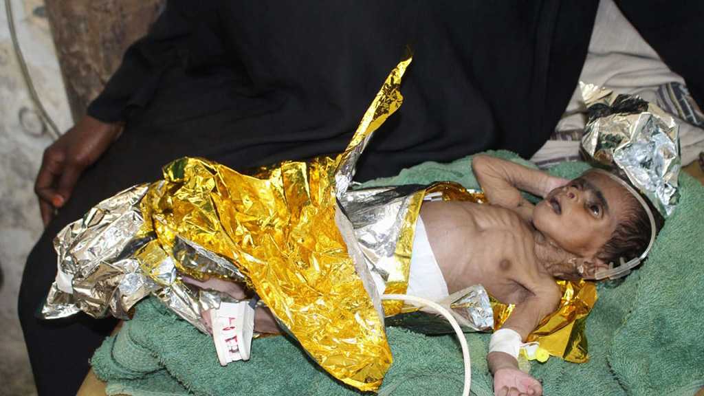 Ramener la paix au Yémen ne suffira pas à sauver ses enfants, dit l’UNICEF