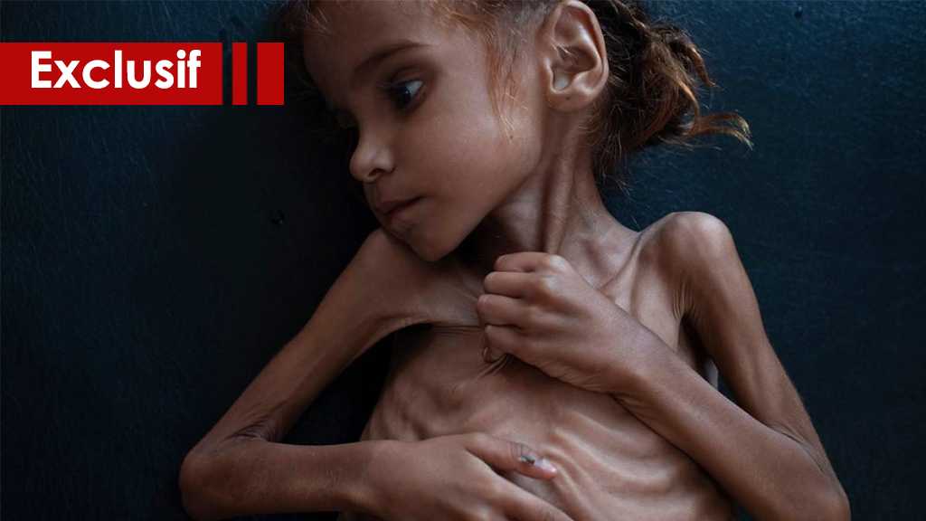 Oui, vous êtes capables d’aider les enfants affamés du Yémen !