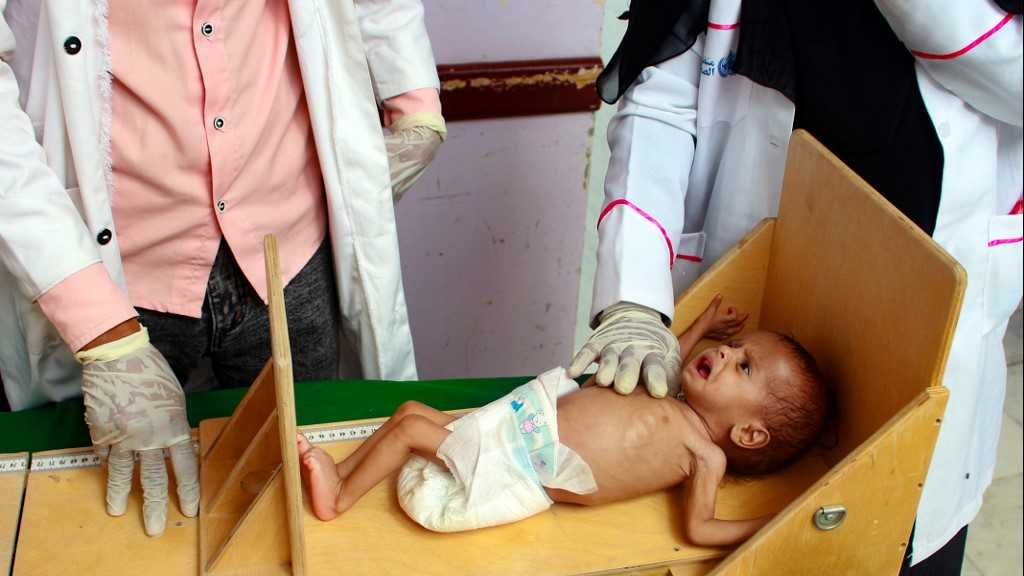 Covid-19: la pandémie aggrave la malnutrition des enfants