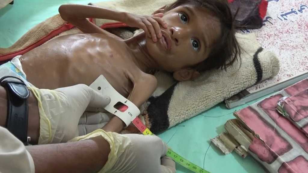 Réduction des programmes humanitaires au Yémen, «théâtre de la pire crise humanitaire au monde»