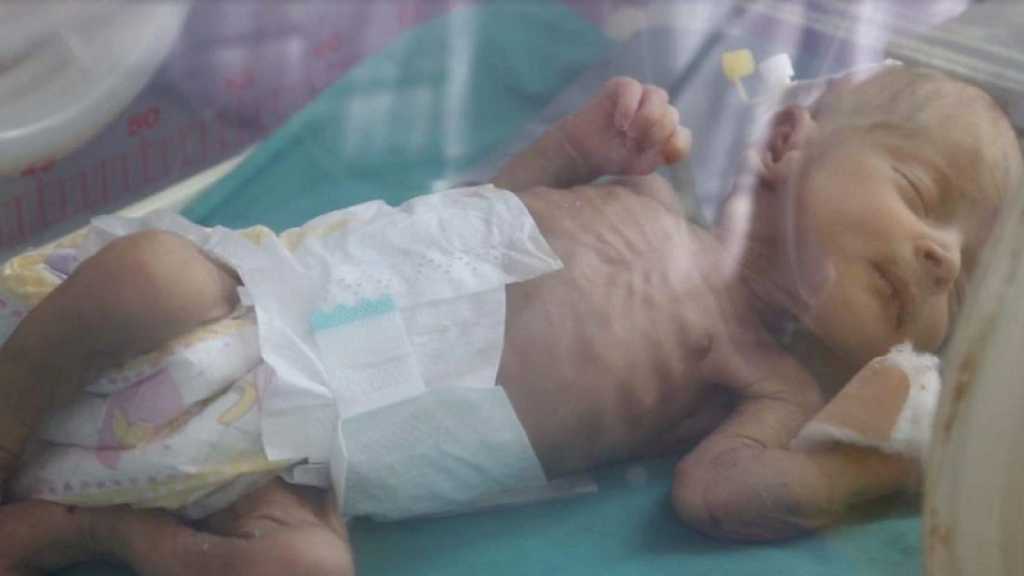  2,3 millions d’enfants yéménites exposés à la famine, s’alarme Save The Children