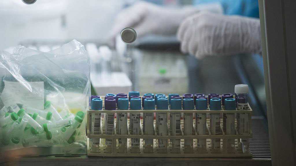 Les cas détectés de variole du singe pourraient n’être que «le sommet de l’iceberg», avertit l’OMS