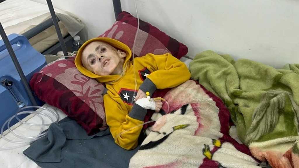 Le Gazaoui de 10 ans qui est devenu le visage de la famine