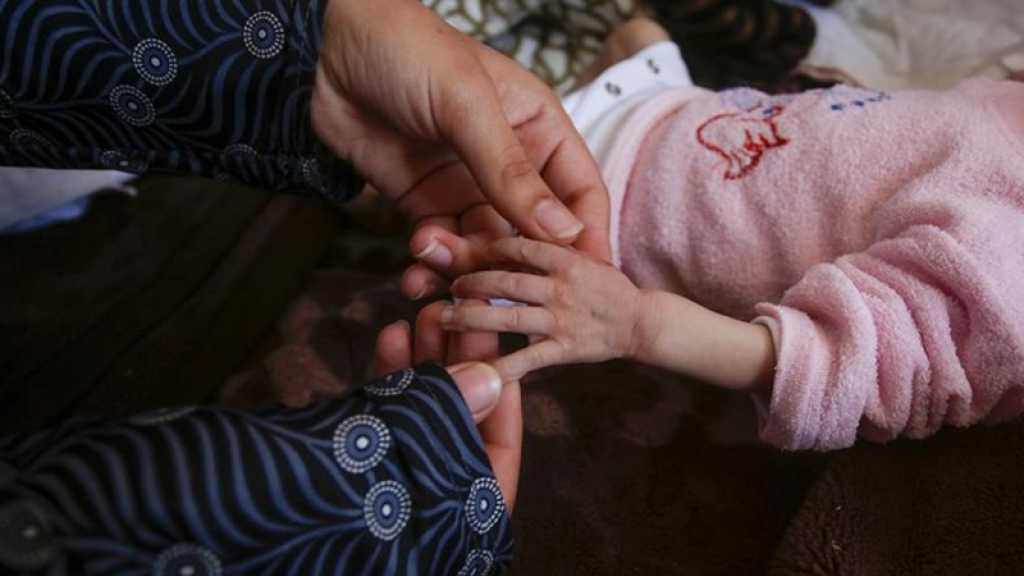Guerre à Gaza: Un bébé est né sans cerveau, le phénomène des malformations fœtales augmente